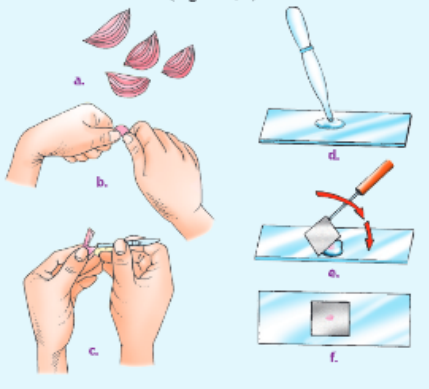 Fundamentals-unit-of-life-preparation-of-a-temporary-stained-mount-of-onion-peel