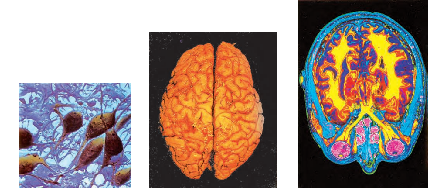 Thebrainconsistsofmillionsofnervecellslikethese,carryingmillionsofmessagestoandfromthebrain.