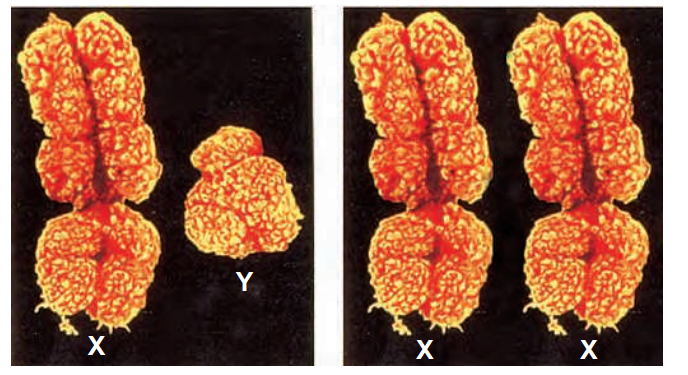 Thesexchromosomes