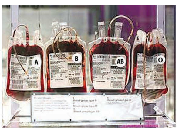TherearefourbloodgroupsA,B,AB,O.