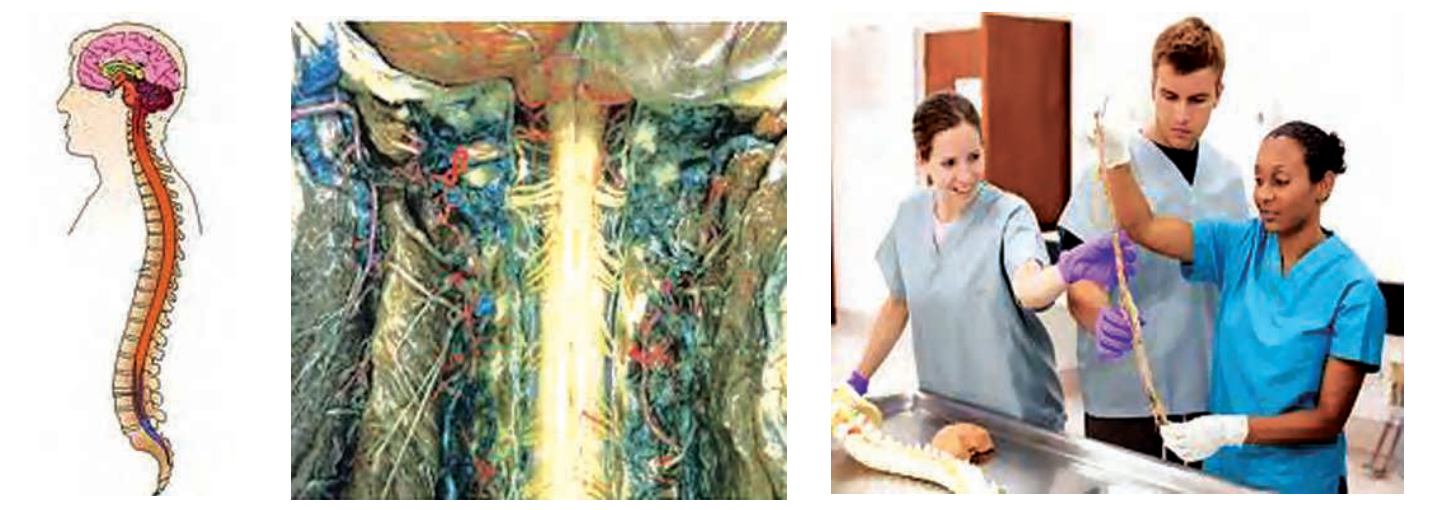 Thissketchshowsspinalcordenclosedinabonycagecalledvertebralcolumn