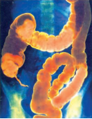life-process-The-X-ray-photograph-of-large-intestine-taken-after-the-person-had-been-given-a-barium-meal- figure -36