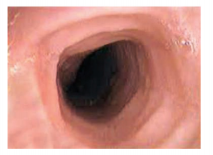 life-process-the-inner-side - of- the -food -pipe - as- viewed - by - an - endoscope- figure -30
