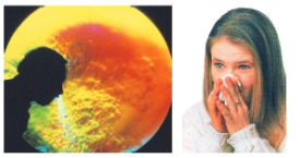 whydowefallillairborneinfection