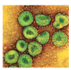 whydowefallillsarsviruses