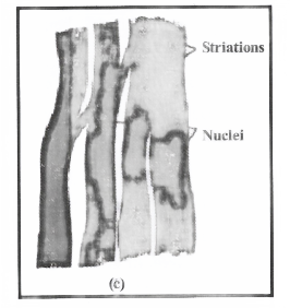 Tissues Cardiac muscle